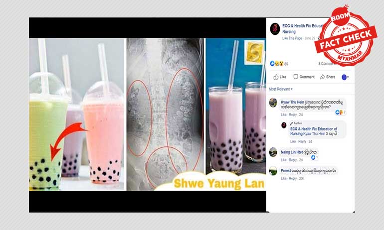 Bubble Tea သောက်ခြင်းက အသက်အန္တရာယ် ထိခိုက်စေသလား Bubble Tea သောက်ခြင်းက အသက်အန္တရာယ် ထိခိုက်စေသလား