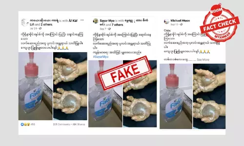 ဒီပုံတွေက လက်သန့်ဆေးအတုကြောင့်ဖြစ်တဲ့ပုံတွေ မဟုတ်ပါ