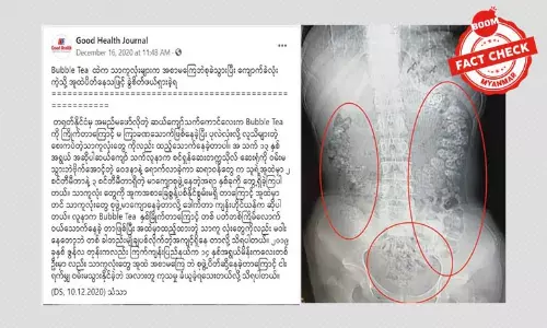 Bubble Tea အလုံးတွေ ဗိုက်ထဲပိတ်မိတယ်ဆိုတဲ့ သတင်းအမှား