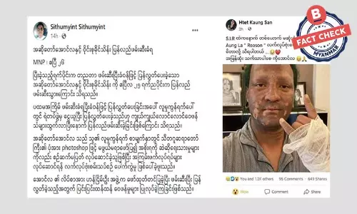 အဆိုတော်အောင်လ လက်လုပ်ဗုံးစမ်းသပ်စဉ်ပေါက်ကွဲကြောင်း ဖြန့်ဝေတဲ့သတင်းမှား