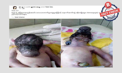 မြေရှားသတ္တုကြောင့်ဖြစ်တယ်ဆိုတဲ့ ဒီပုံက ကချင်ကမဟုတ်ပါ မြေရှားသတ္တုကြောင့်ဖြစ်တယ်ဆိုတဲ့ ဒီပုံက ကချင်ကမဟုတ်ပါ