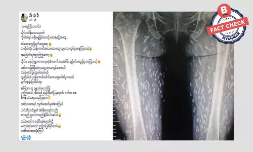 ဝက်သားအစိမ်းစားတဲ့ ထိုင်းအမျိုးသမီး ခန္ဓာကိုယ်မှာ သန်ကောင်တွေ တွေ့တယ်ဆိုပြီး ဖြန့်ဝေနေတဲ့ သတင်းအမှား ဝက်သားအစိမ်းစားတဲ့ ထိုင်းအမျိုးသမီး ခန္ဓာကိုယ်မှာ သန်ကောင်တွေ တွေ့တယ်ဆိုပြီး ဖြန့်ဝေနေတဲ့ သတင်းအမှား
